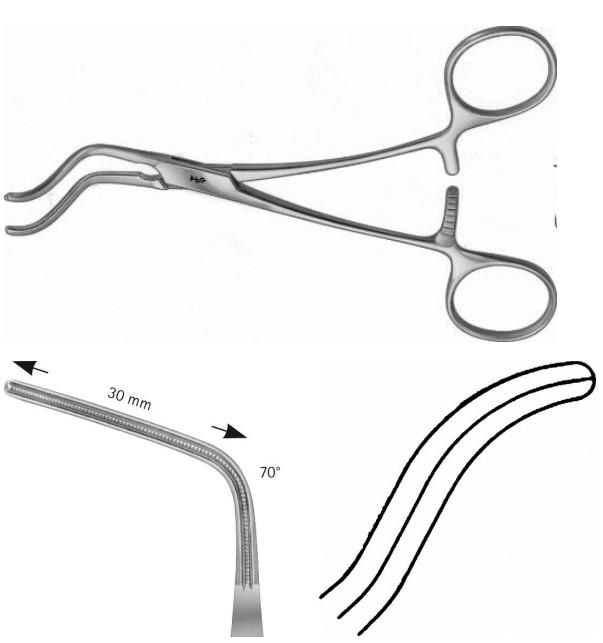 САБРЕМЕНІАН АТРАВМАТ. АОРТ. ЗАТИСКАЧ 155MM